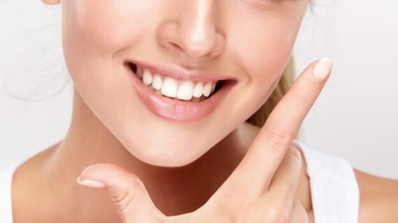 Cara alami memutihkan gigi kuning dan bagaimana pencegahannya