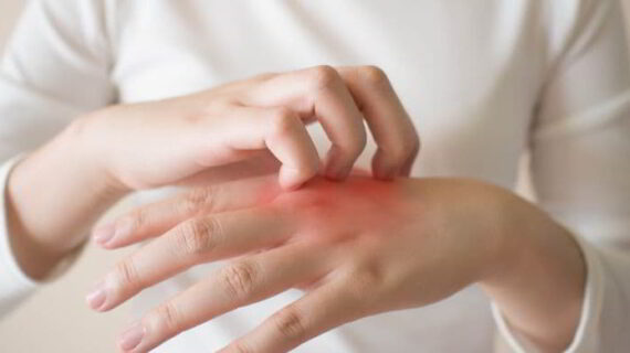 Penyebab kulit gatal, 4 masalah yang harus diketahui sebelum pengobatan